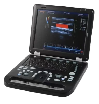 SUNBRIGHT SUN-906B ultrasound machine