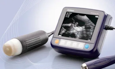 SUNWAY Wristscan V9 ultrasound machine