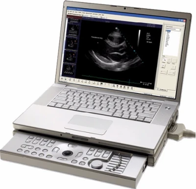 TERASON Echo ultrasound machine