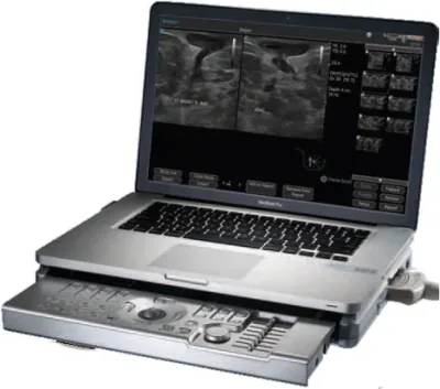 TERASON t3000 ultrasound machine
