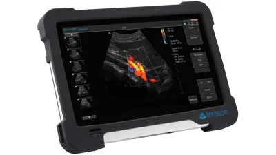 TERASON uSmart 3200T ultrasound machine