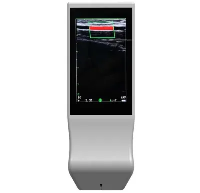 TEVEIK Wifi ultrasound machine