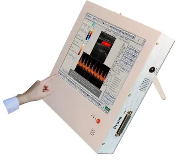 TOUCHSCAN 8Vet ultrasound machine