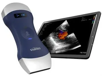 VIATOM Dual-Head ultrasound machine