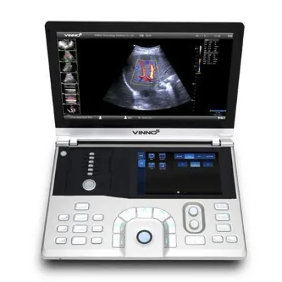 VINNO 5 ultrasound machine