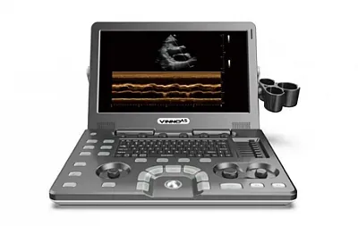 VINNO A5 ultrasound machine