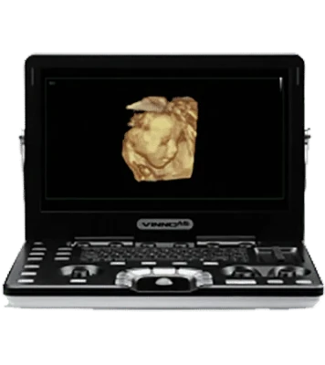 VINNO A6 ultrasound machine