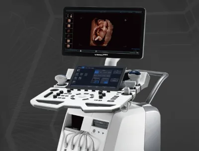 VINNO M86 ultrasound machine