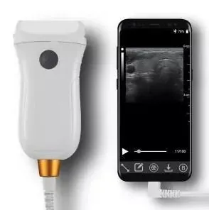 WALEETA MX5 ultrasound machine