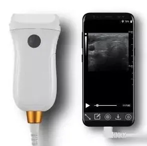 WALEETA MX5 Plus ultrasound machine