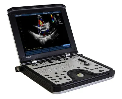 WHALE Sigma P5 ultrasound machine