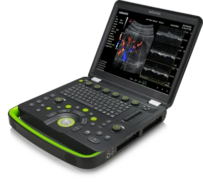 WISONIC Clover 60 ultrasound machine