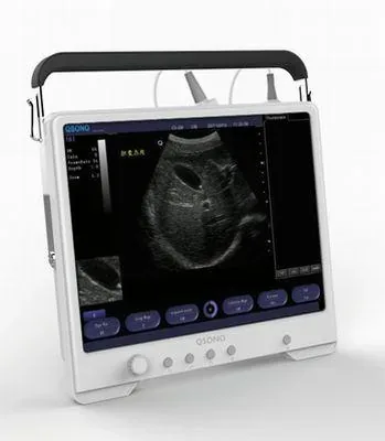 WUERWEI Q3 ultrasound machine