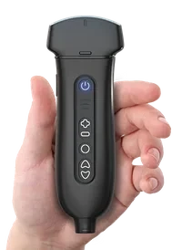 YOUKEY GERMANY GMBH Q7 ultrasound machine