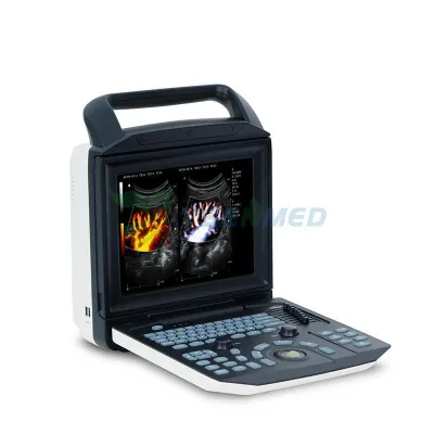 YUESHEN MEDICAL YSB-M5 ultrasound machine