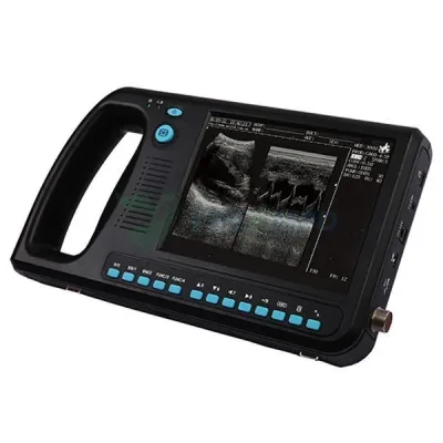 YUESHEN MEDICAL YSB3000 ultrasound machine
