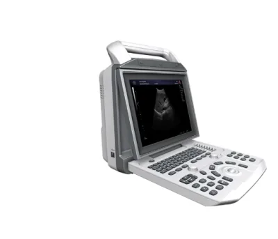 ZONCARE i50 ultrasound machine