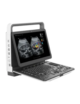 ZONCARE M30 ultrasound machine