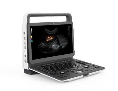 ZONCARE VU2EXP ultrasound machine