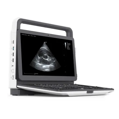 ZONCARE VU3EXP ultrasound machine